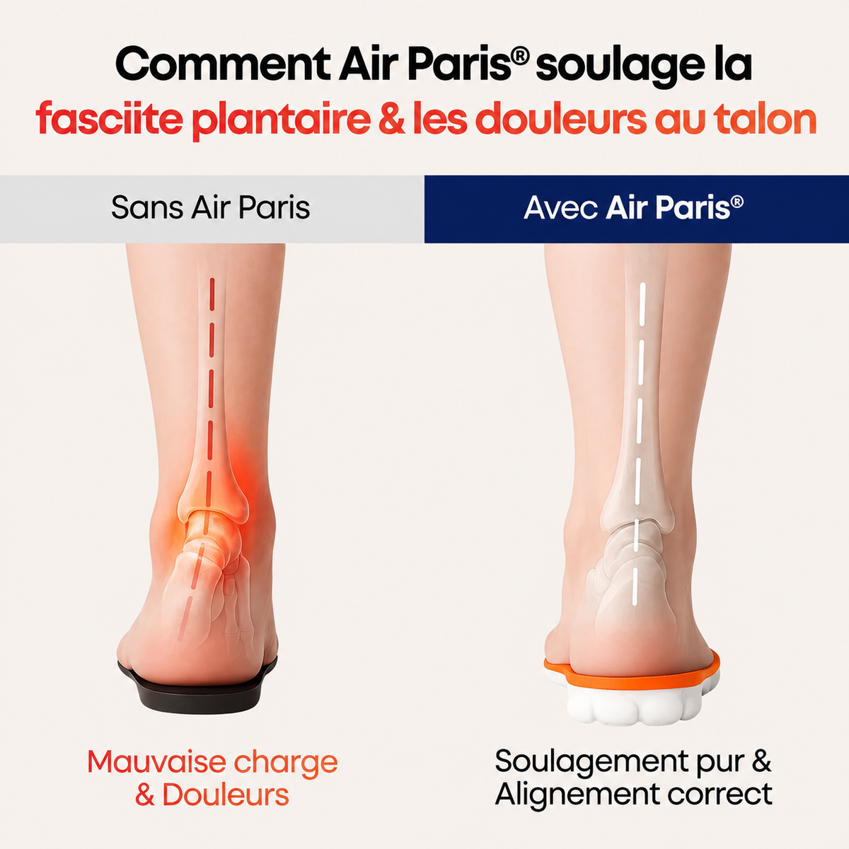 Air Paris - Semelles de Soulagement